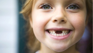 Как вырвать ребенку молочный зуб: показания