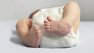 Врожденная косолапость у ребенка: причины и лечение методом Понсети