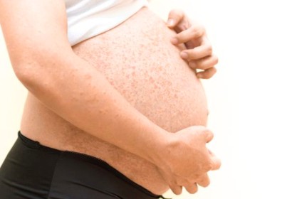 Краснуха при беременности: симптомы и последствия для плода